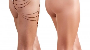 Butt Body Fillers 800